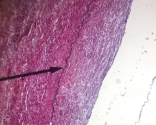 <p>what kind of tissue is this </p>