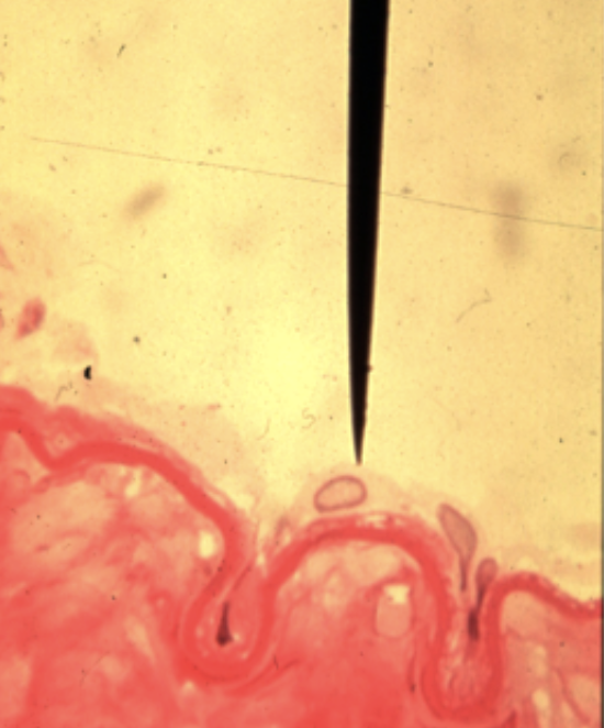 <p>zoom</p>