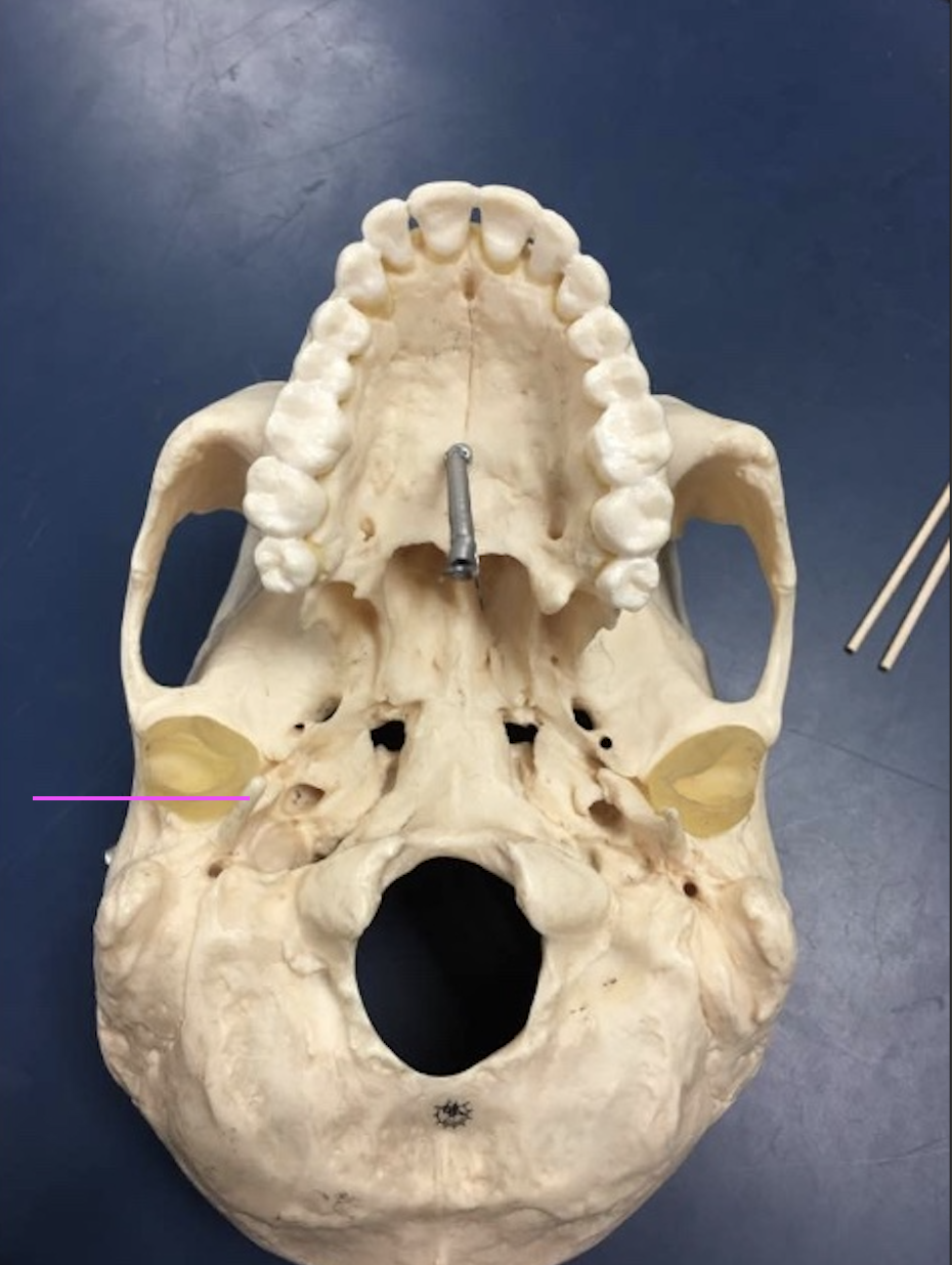 <p>What bone marking is this?</p>