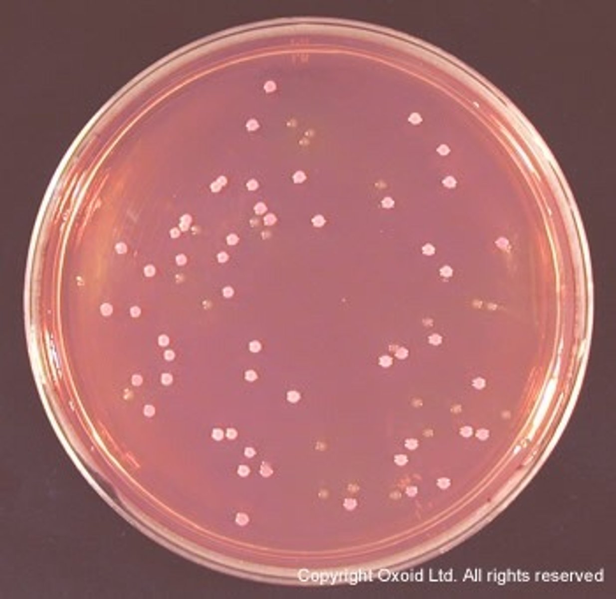 <p>MacConkey Agar with Sorbitol.</p><p>E. coli 0157:H7 does not ferment sorbitol and usually produce colorless colonies on MacConkeys Agar.</p>