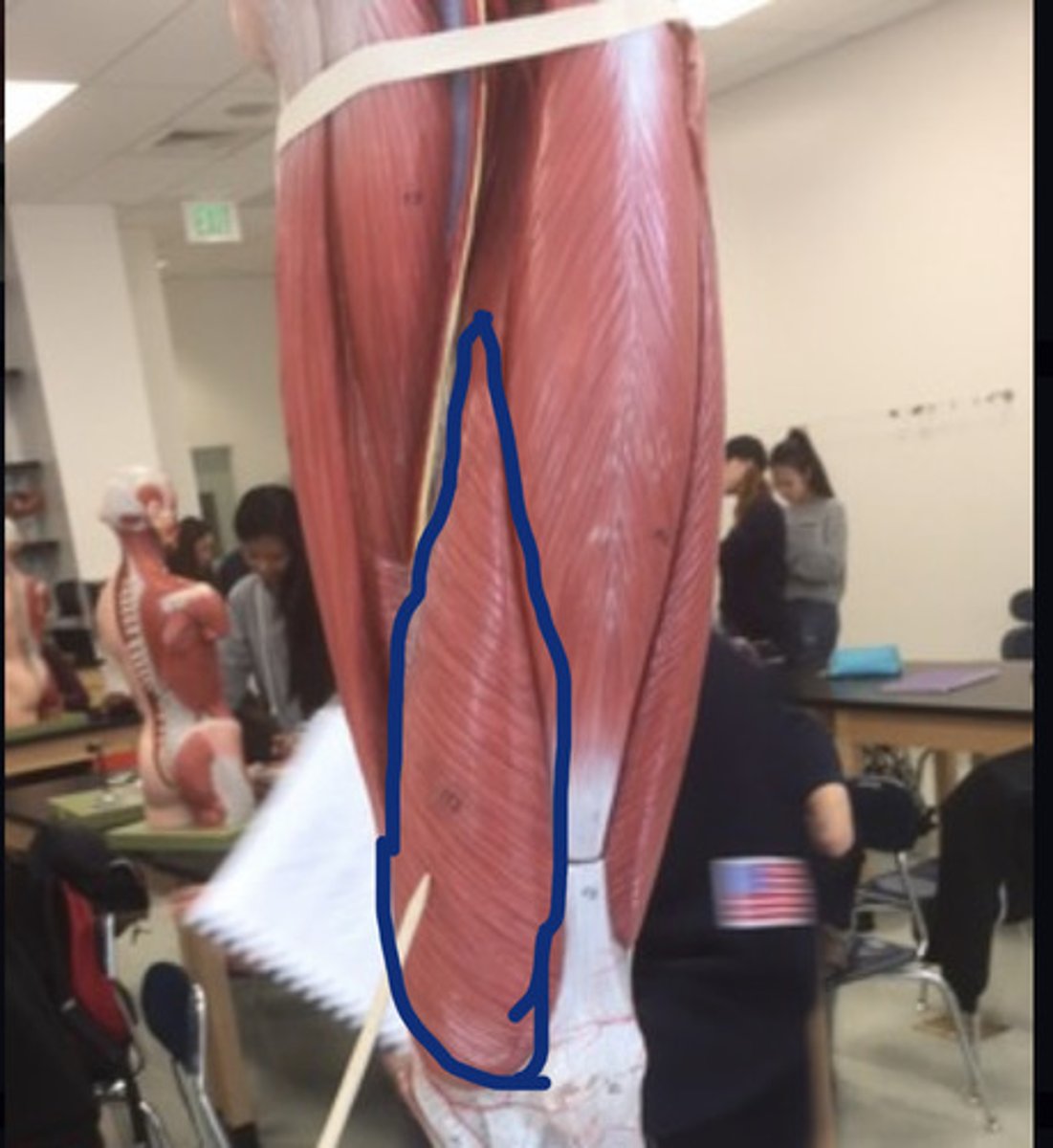<p>medial side</p>