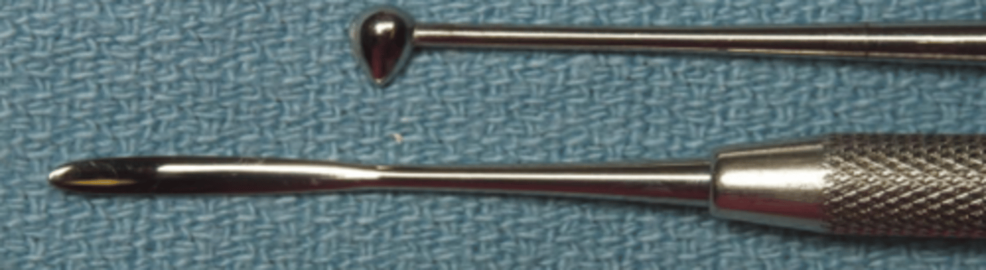<p>overpacked amalgam is burnished immediately with a large burnisher, using heavy strokes mesiodistally and faciolingually</p>