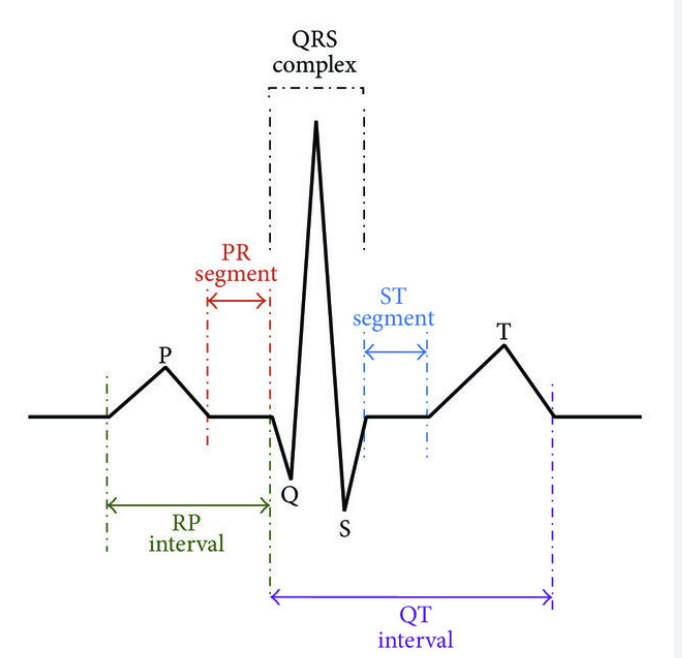 <p>measures electric activity of systole and diastole to identify problems eg heart attacks</p><ul><li><p>p-wave atrial</p></li><li><p>qrs complex ventricular</p></li><li><p>t-wave diastole</p></li></ul>