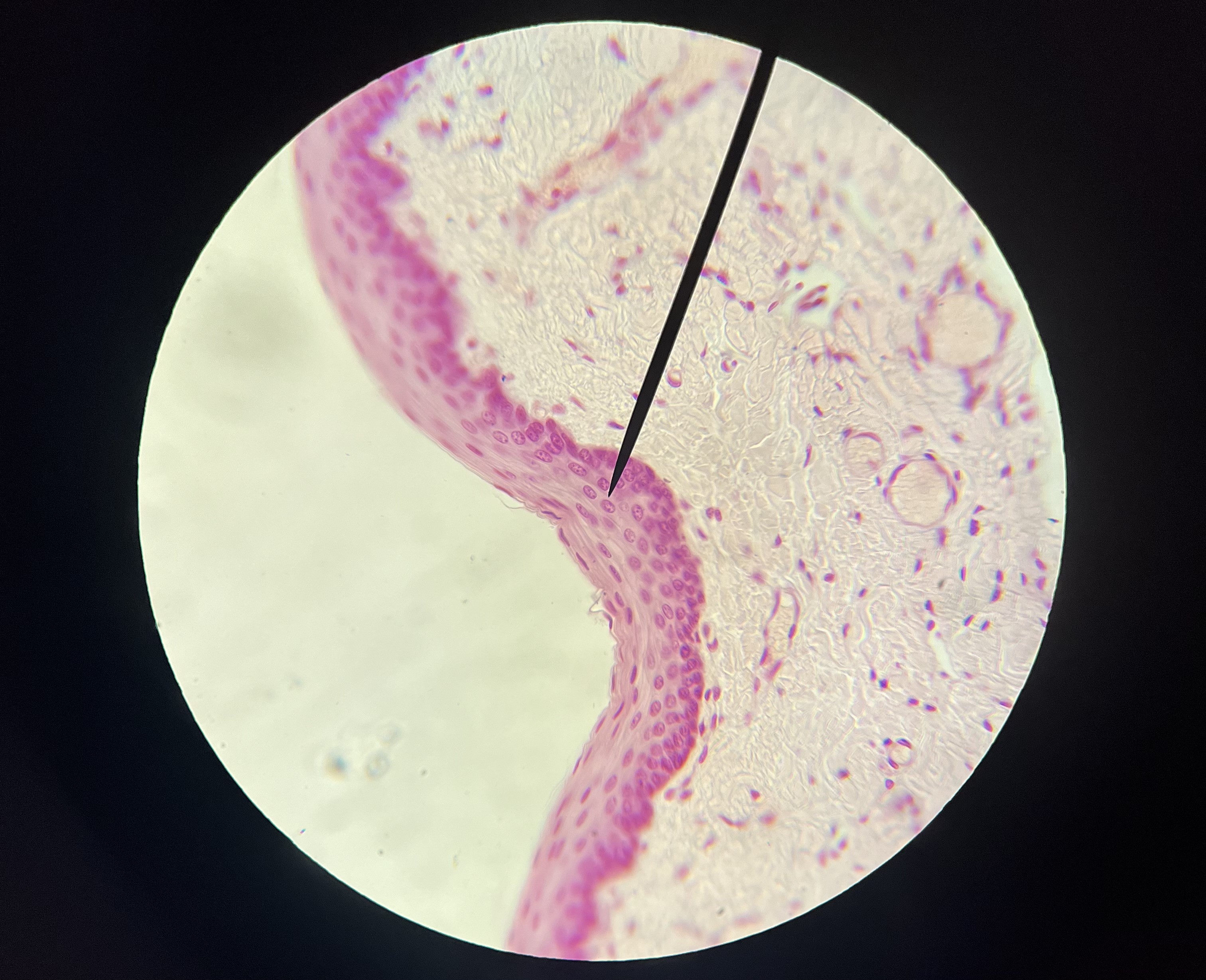 <p>stratified squamous epithelium</p>