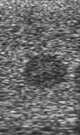 Identify the echogenicity