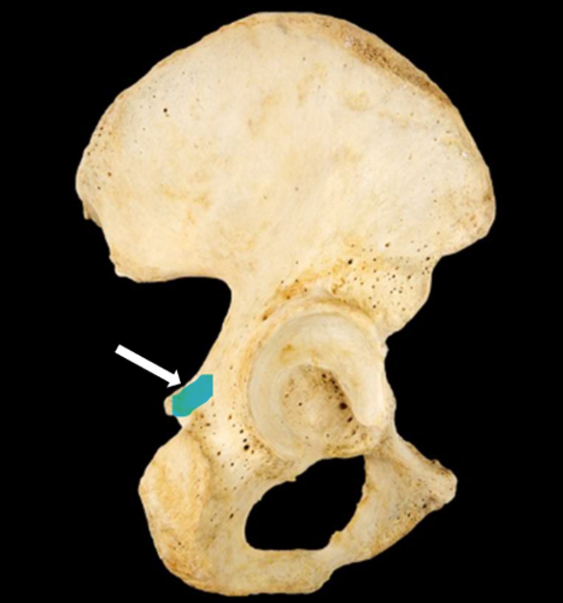 <p>name the part</p>