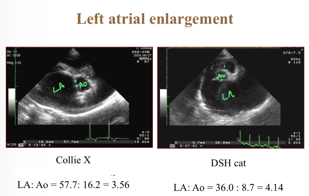<p>Causes of LA enlramgent </p>