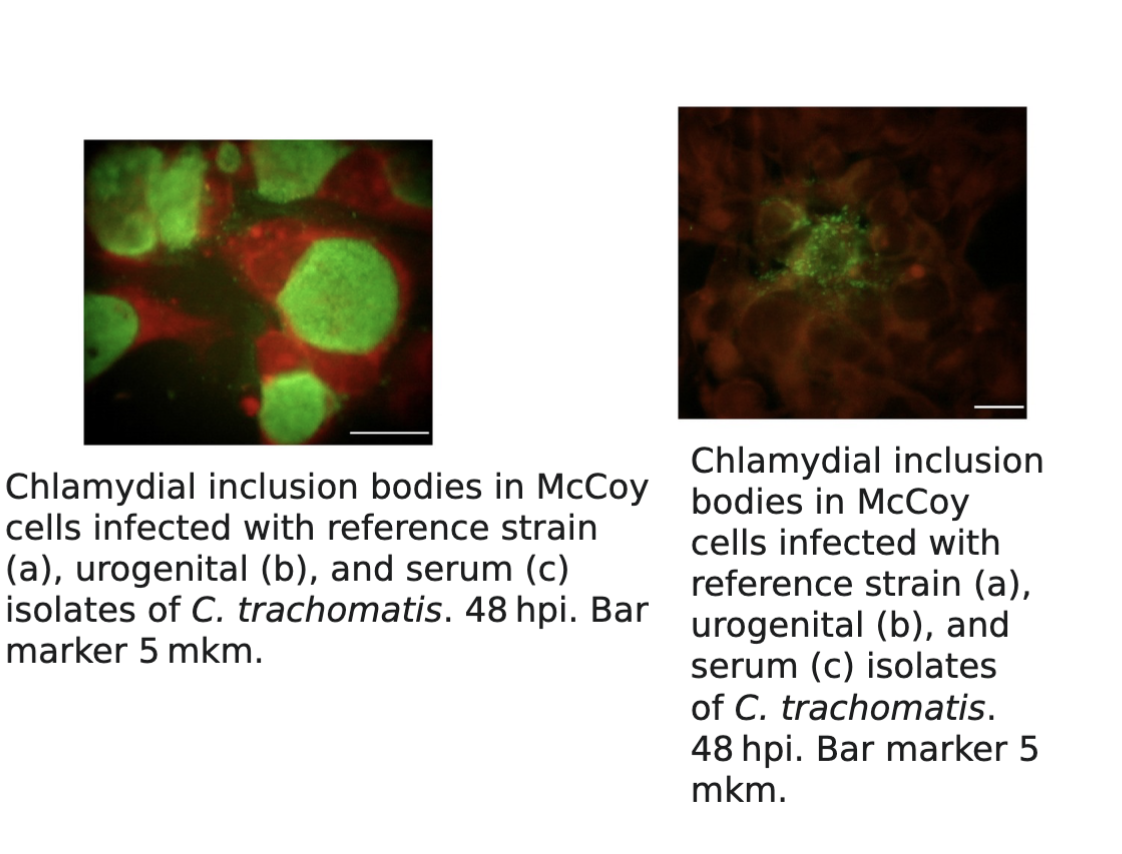 <ul><li><p>Cell culture on<strong> HeLa, McCoy and monkey kidney cells</strong></p><p>for cultivation of organisms</p></li><li><p> Monolayer of cell culture is stained and examined for perinuclear cytoplasmic inclusions.</p></li><li><p> Iodine, Giemsa, and immunofluorescent stains can be utilized to visualize the organisms.</p></li><li><p> <strong>Chlamydia trachomatis produces compact inclusions containing glycogen, which stain with the iodine as seen in </strong></p></li></ul><p></p><ul><li><p><strong>Nucleic acid amplification and DNA probe</strong></p><ul><li><p>Increases sensitivity and specificity of detection of organisms</p></li></ul></li></ul><p></p>
