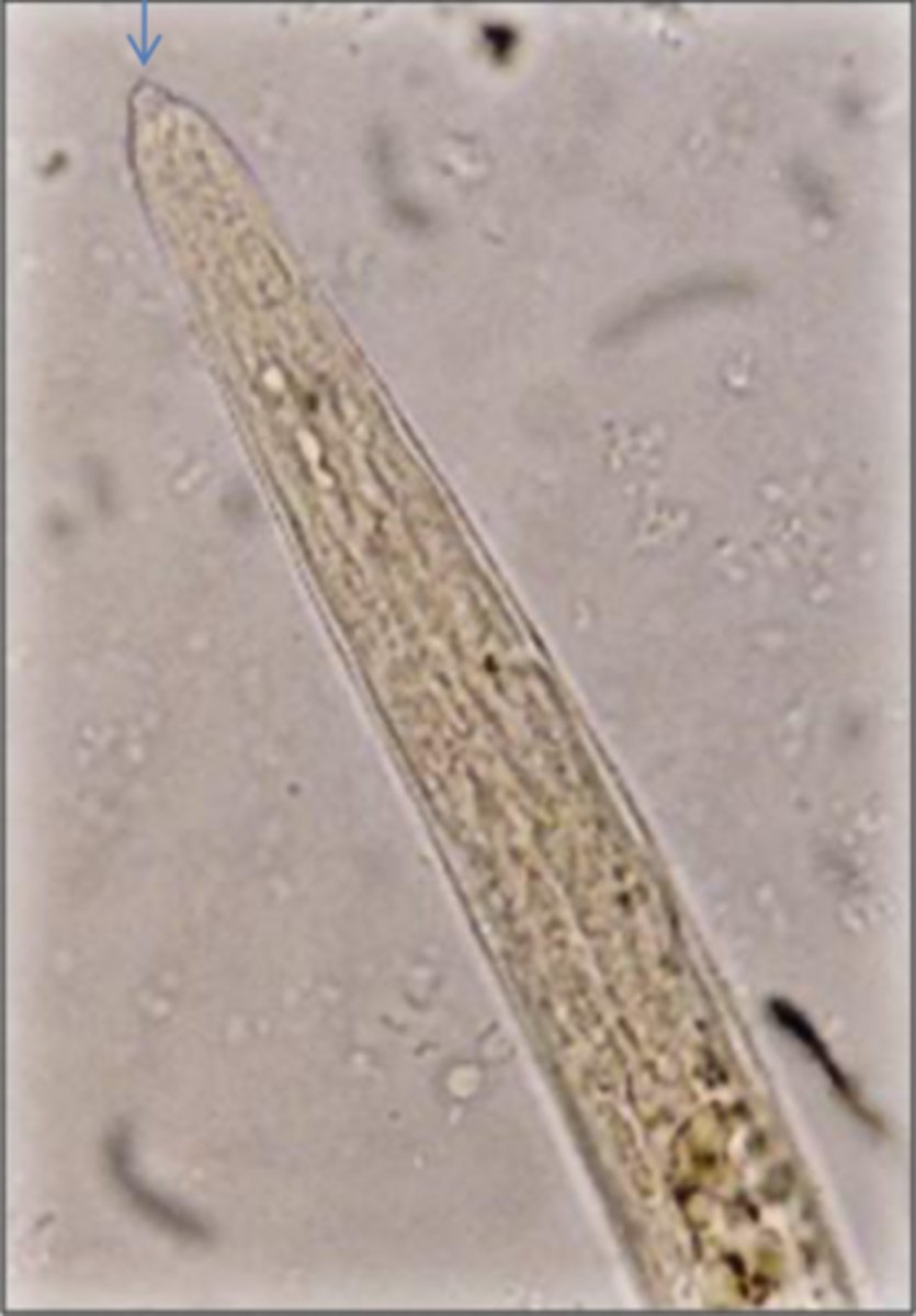 <p>Found in sheep and cattle with severe dyspnoea and white frothy mucous. What parasite is this?</p>