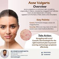 <p>RF: m/c dx in America<br>teenagers (puberty)<br>severe→male<br>more common→female</p><p>E: propionibacterium acnes<br>inflammation<br>androgen+receptors<br>excess sebum<br>plugging of follicle</p><p>CM:<br><u>sebaceous gland activity areas:</u><br>face<br>chest<br>back<br>shoulders</p><p><u>comedonal:</u><br>whiteheads (closed comedones)<br>blackheads (open comedones)</p><p><u>inflammatory:</u><br>papules<br>pustules</p><p><u>nodulocystic:</u><br>comedones/inflammatory lesions+large nodules with/without scarring</p><p>TX:<br><strong>topical</strong><br><u>comedonal+inflammatory→retinoids:</u><br>andapalene (weak)<br>tretinoin<br>tazarotene (weak)</p><p><u>inflammatory acne+p. acnes→abx:</u><br>clindamycin<br>erythromycin<br>dapsone</p><p><u>p. acnes:</u><br>benzoyl peroxide</p><p><strong>oral</strong><br><u>inflammatory+p. acnes→abx:</u><br>doxycycline<br>minocycline</p><p><u>androgen-receptors→hormonal tx:</u><br>contraceptive pills<br>spironolactone</p><p><u>excess sebum:</u><br>isotretinoin<br>-teratogenic<br>-monthly pregnancy tests<br>-Ipledge registration<br>-monthly bloodwork<br>-not for hormonal acne<br>-15+ y/o (fully developed skin glands)</p><p>P: POC→post-inflammatory hyperpigmentation→tx aggressively</p>
