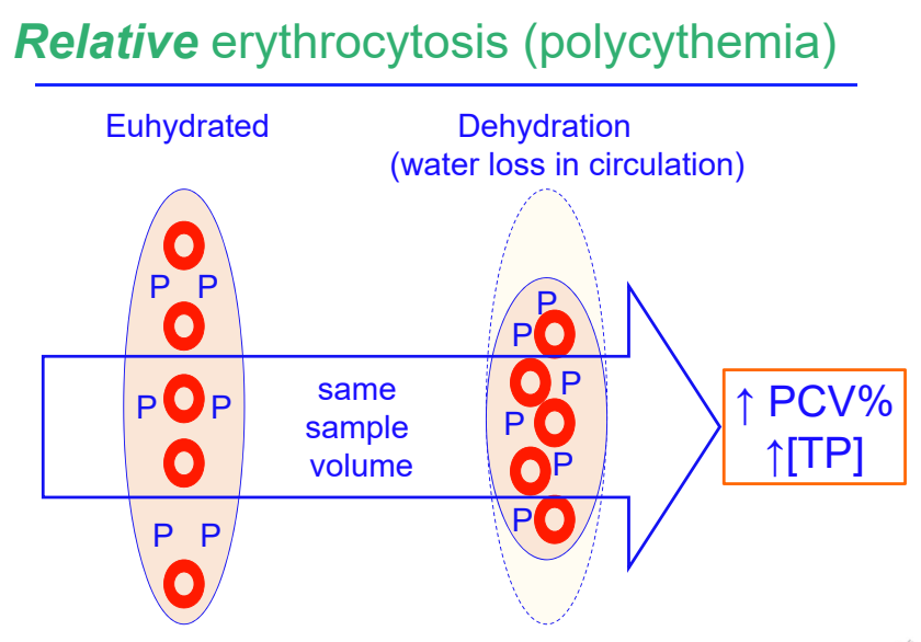 <ul><li><p>most frequent cause of relative erythrocytosis</p></li><li><p>no absolute increase in RBC mass</p></li><li><p>no increase in EPO</p></li><li><p>increase relative to plasma H<sub>2</sub>O</p></li></ul><p></p>