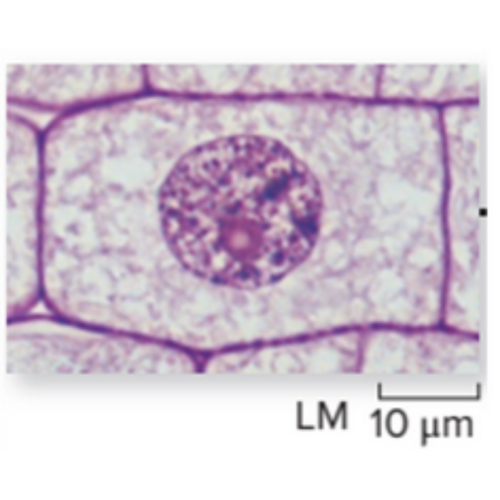 <p>What kind of cell is shown? Name the phase that it is experiencing.</p>