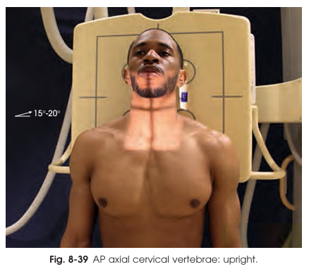 <p>At what angle and through which vertebral level should the central ray be directed for an <strong>AP axial cervical spine</strong> projection?</p>