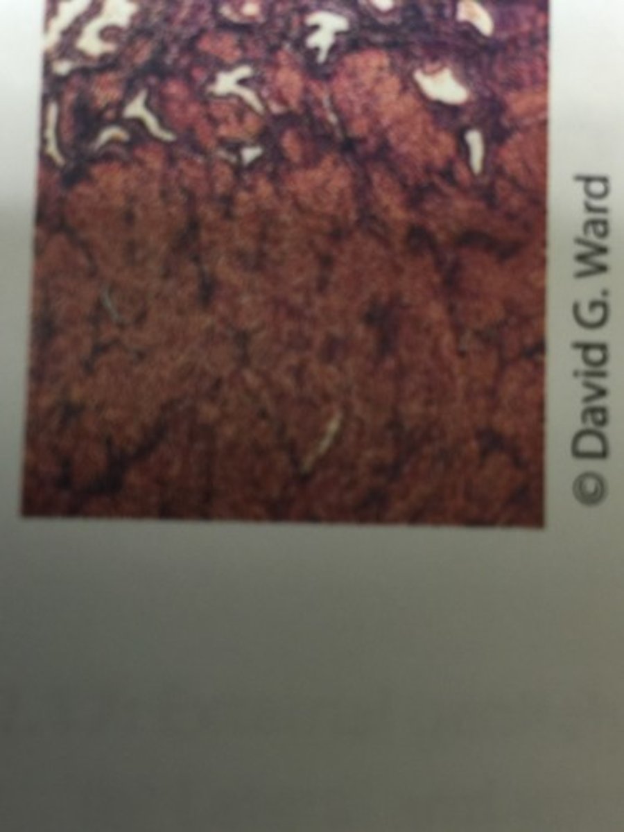 <p>The thickest layer of the wall of the uterus.</p>