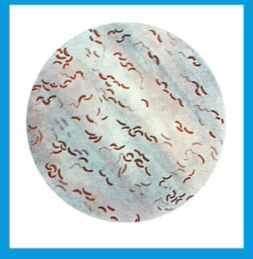 <p><strong>Asporogenous</strong>, curved (comma) or pleomorphic gram (-) rods</p><p></p>