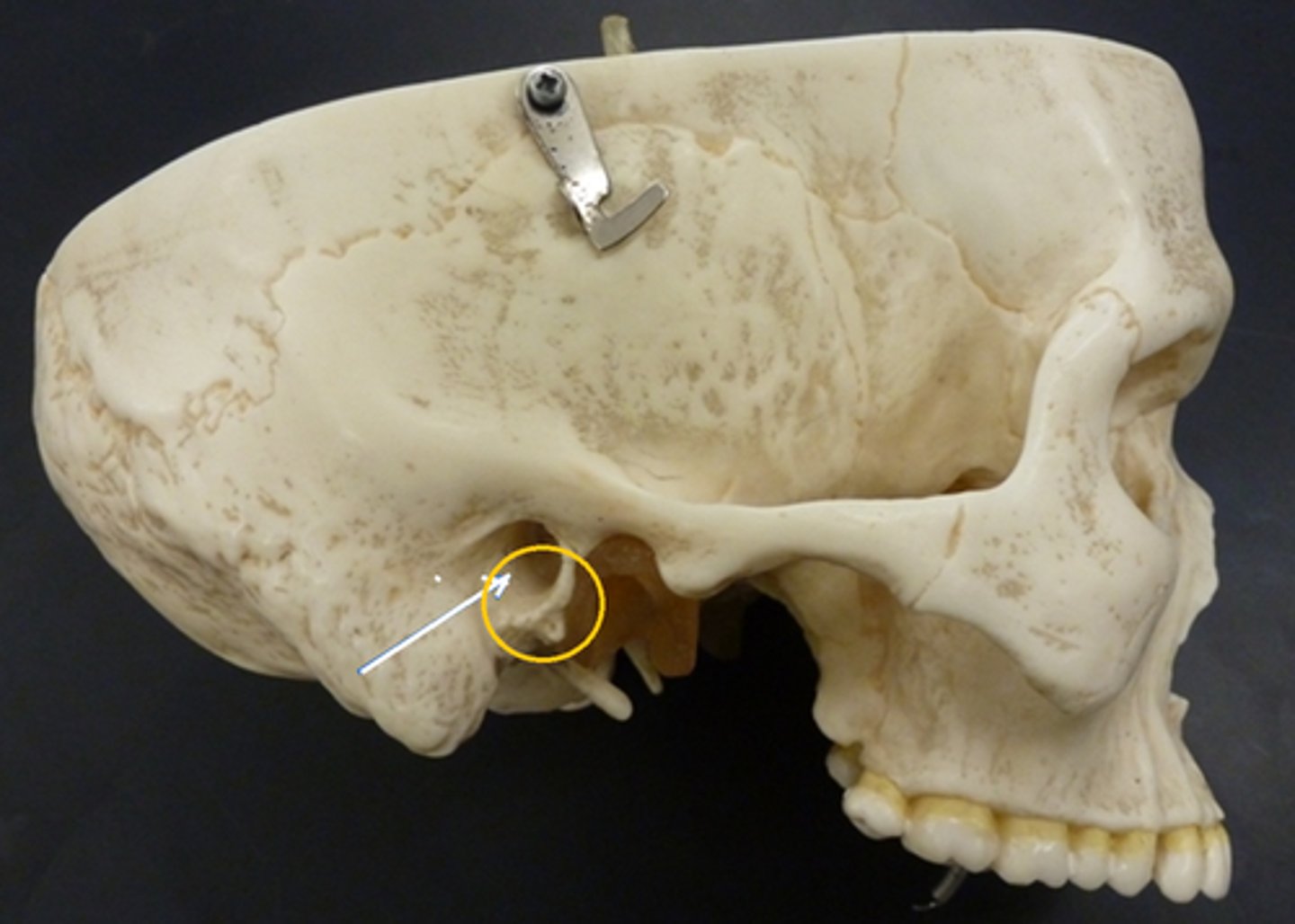 <p>inferior projection of the articular surface at the medial edge of the articular eminence</p>