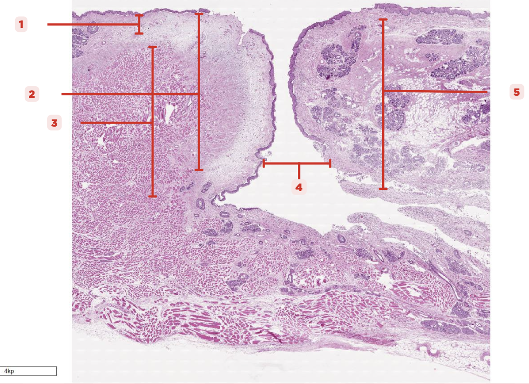<p>Identify the structure labeled as 3.</p>