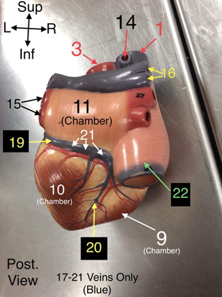 <p>20.A vein that drains the right ventricle and the interventricular septum.</p>