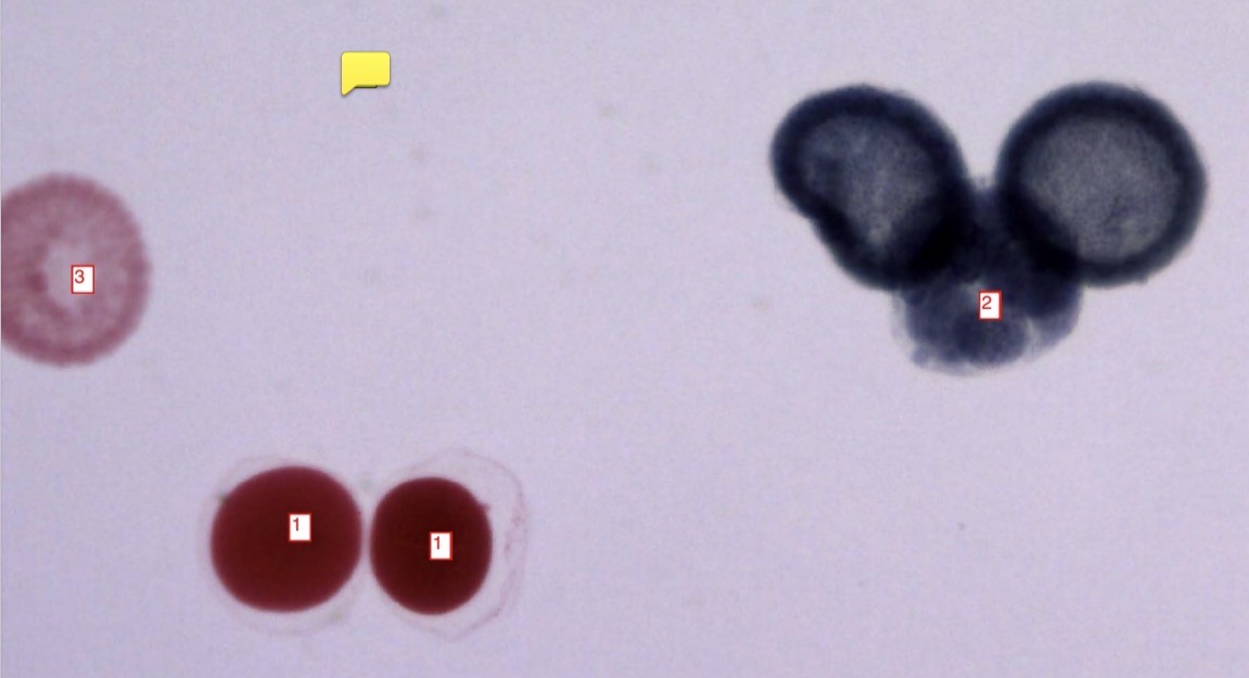 <p>starfish development stages- (1)</p>