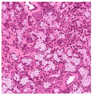 <p>what gland is this</p>
