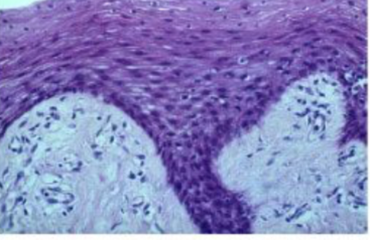 <p>Stratified Squamous: Non keratinized</p>