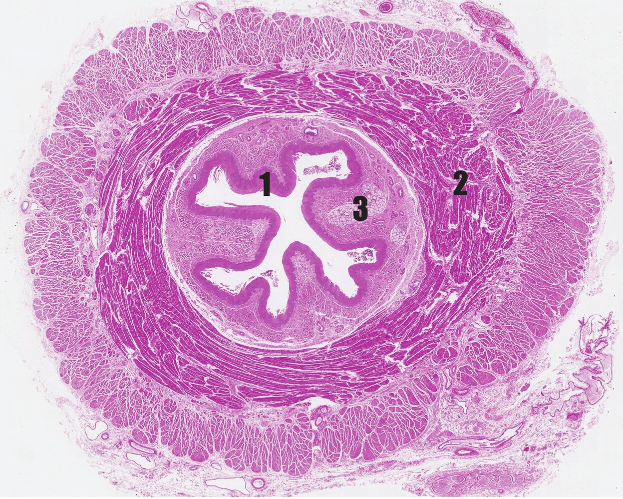 <p>19. Which statement about the histological image is correct?</p><p>A. The organ shown contains skeletal muscle in its upper part.</p><p>B. The section of the organ shown is entirely covered by a tunica serosa.</p><p>C. Number 1 marks a pseudostratified ciliated epithelium.</p><p>D. Number 2 marks the lamina muscularis mucosae.</p><p>E. Number 3 marks the myenteric plexus (Plexus myentericus).</p>