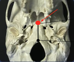 <p>Most posterior midline point on the vomer</p>