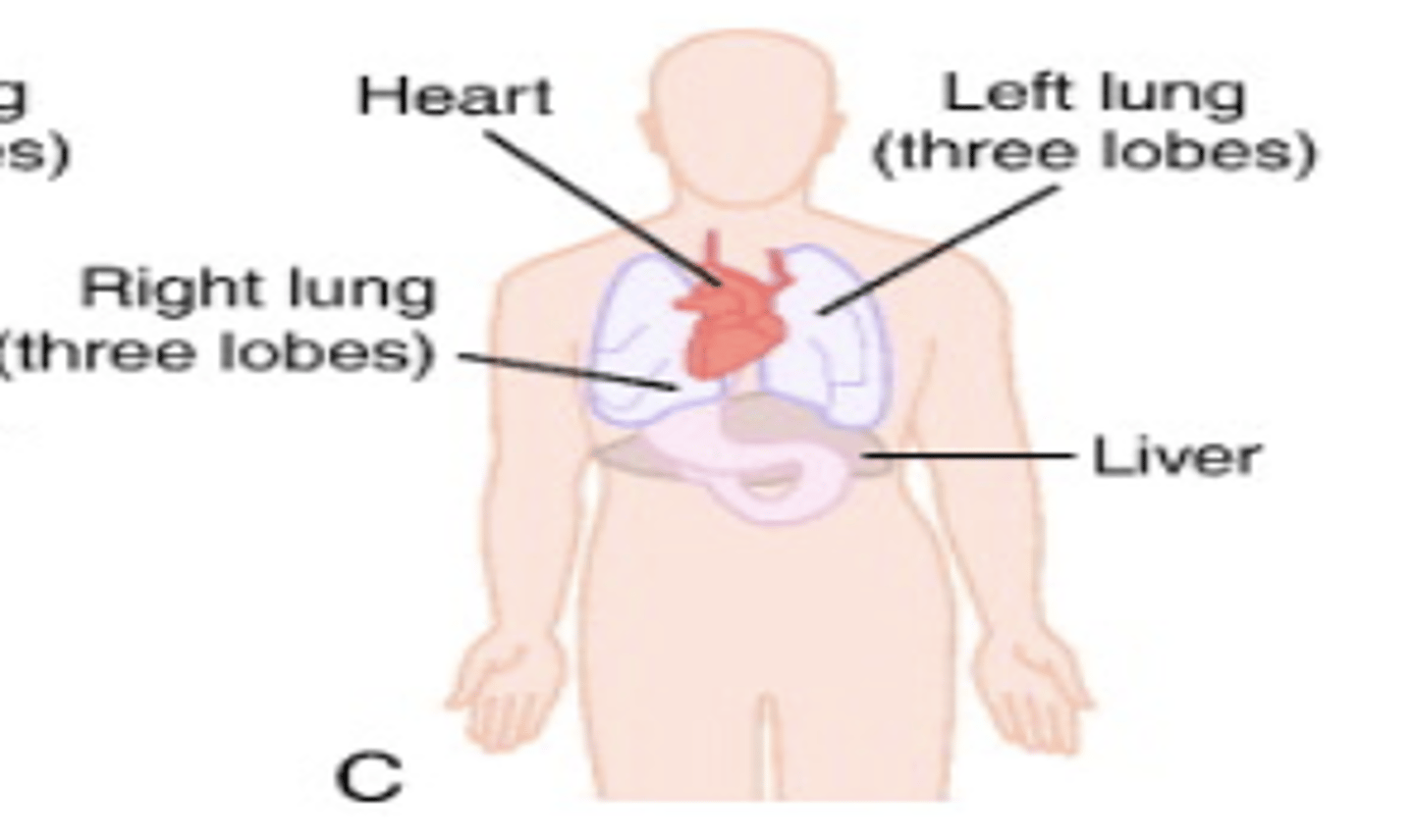<p>randomization of organ placement</p><p>(heterotaxy)</p>