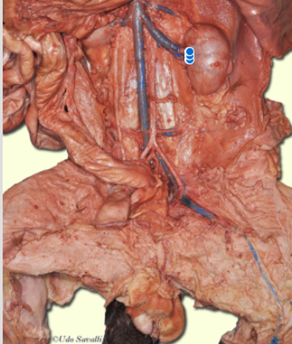 <p>Filters blood to produce urine.</p>