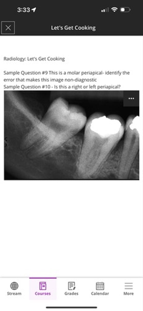 <p>1. You cannot see the 2-3mm apical of both molars</p><p>2. right</p>