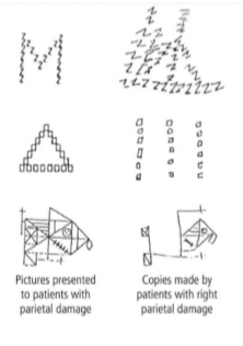 <p>The right parietal lobe is more important in the spatial allocation of attention (directing our attention) </p><ul><li><p>Important for global features </p></li><li><p>Able to reproduce specific features of the pictures but not global features </p></li></ul>
