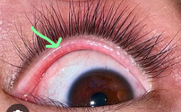 <p>What glands does the green arrow refer to</p>