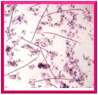 pre larval to Dirofilaria immitis