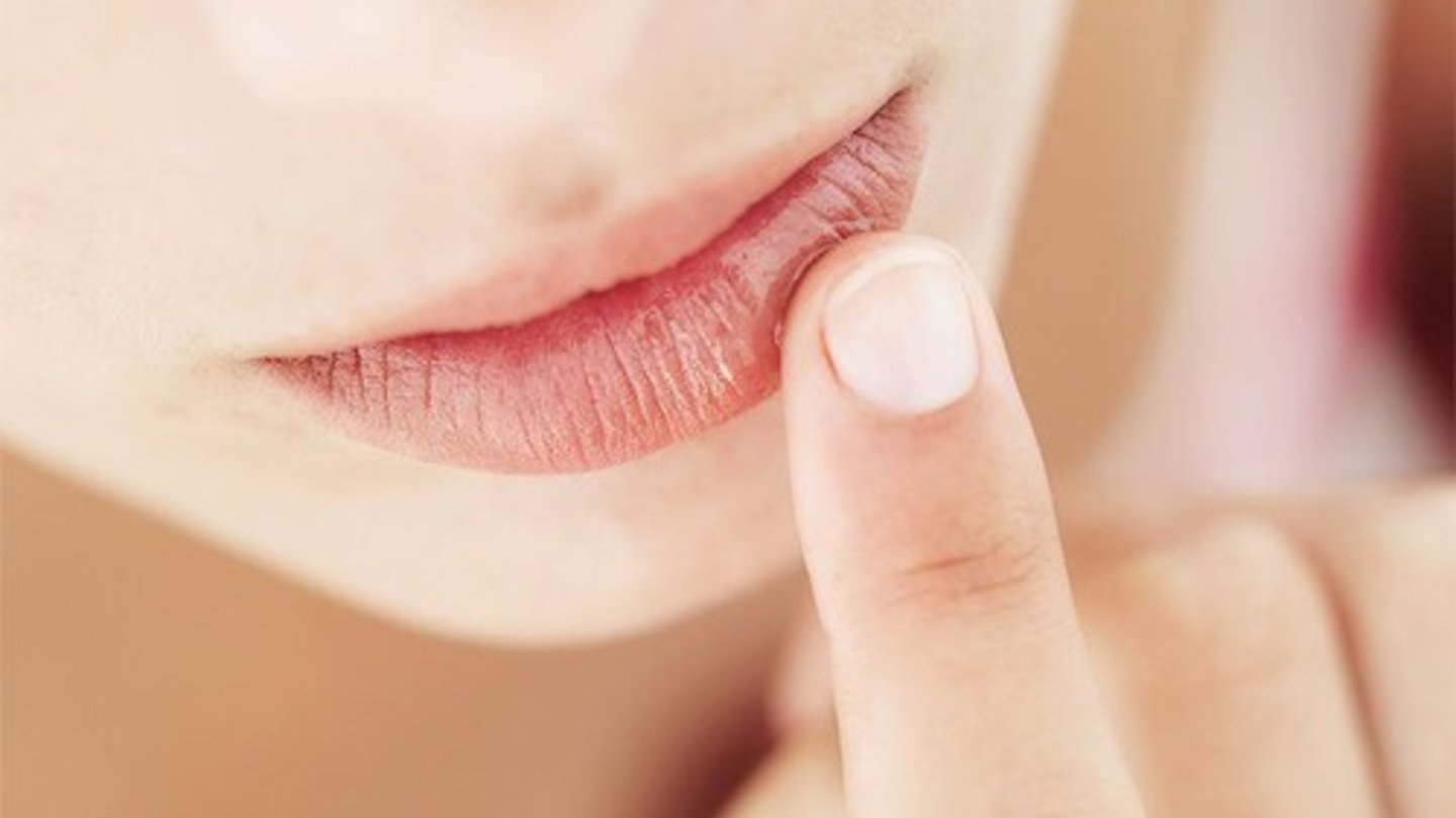 <p>(n.phr): môi bị nứt</p>