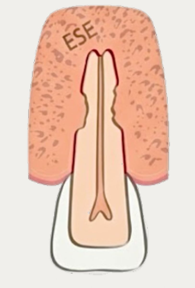 <p>Which type of resorption?</p>