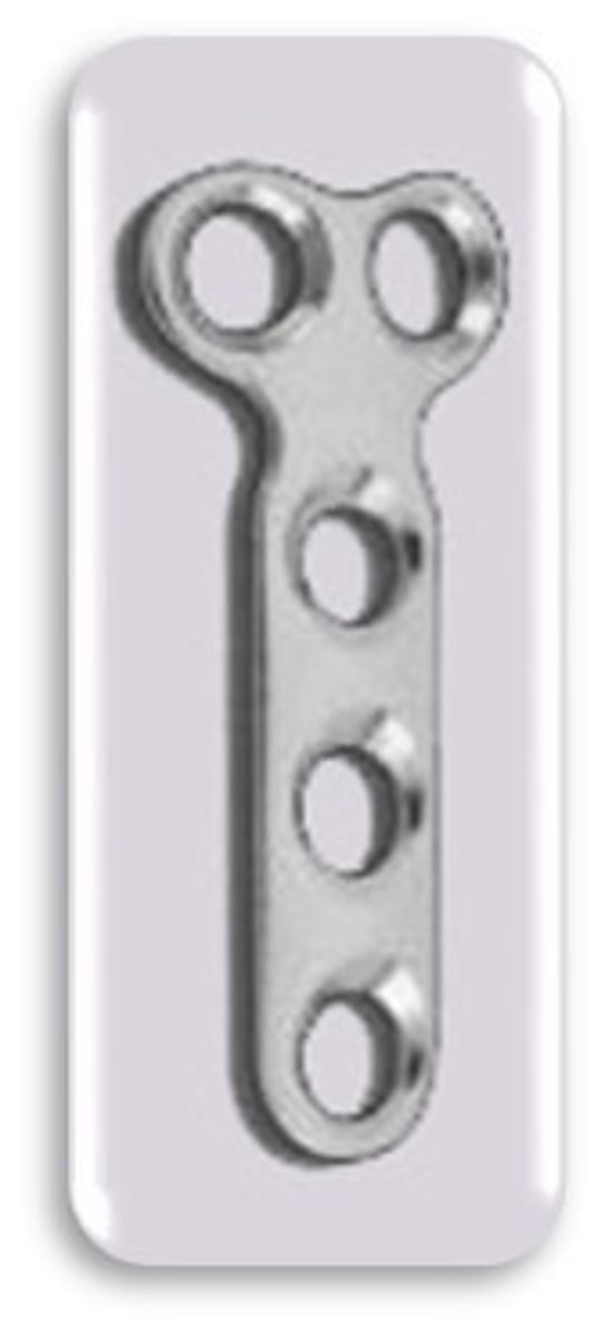 <p>proximal 3rd tibia</p>