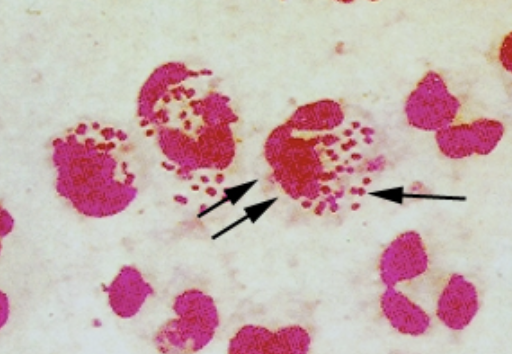 <p>What does this suggest in males? females?</p>