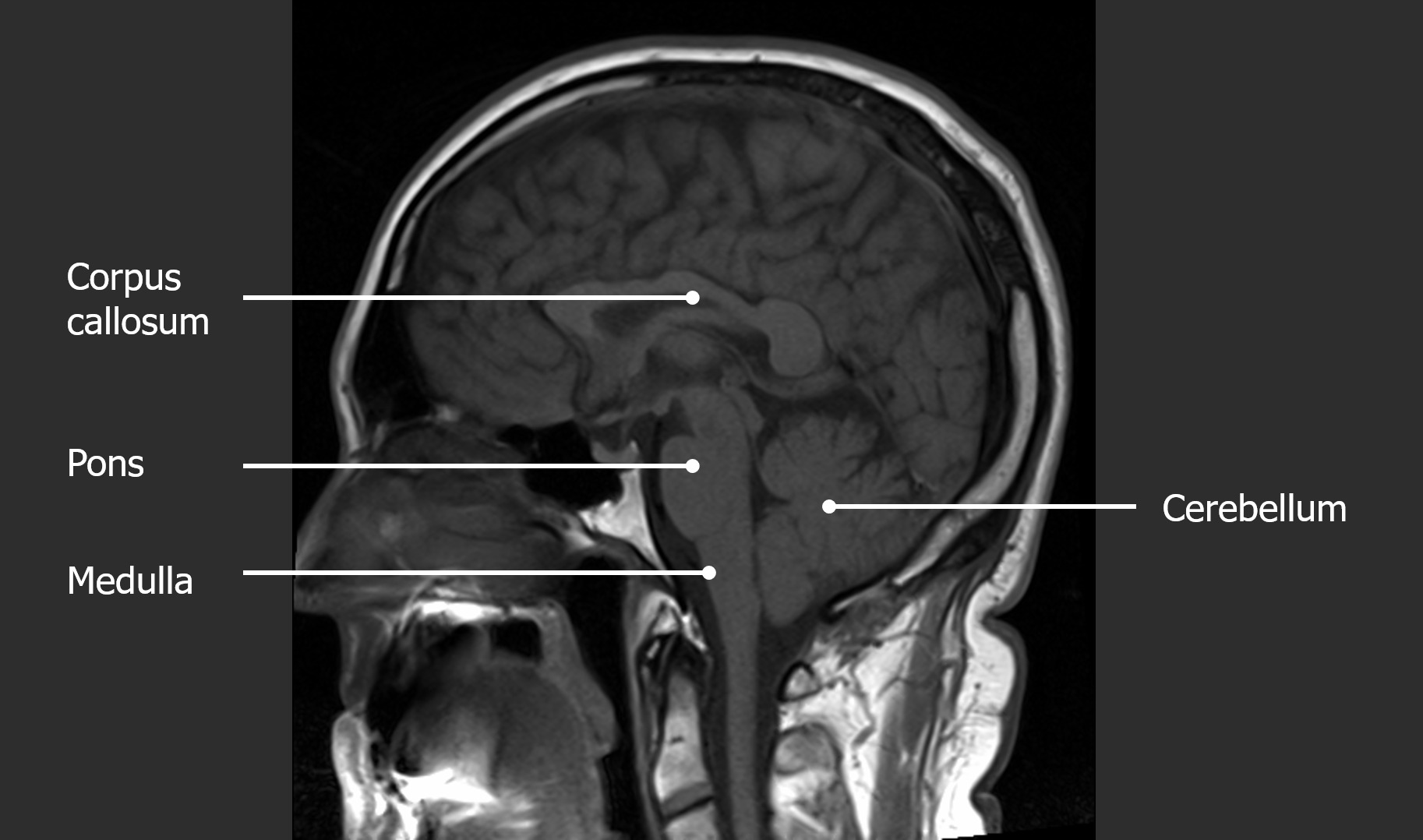 <p>Midbrain, pons, medulla oblongata.</p>