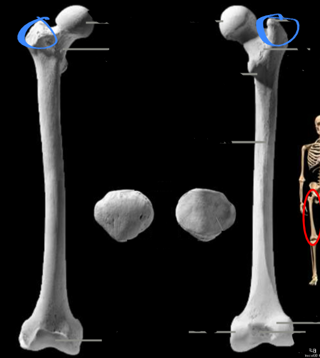 <p>Attachment for glute musculature, located on the femur</p>