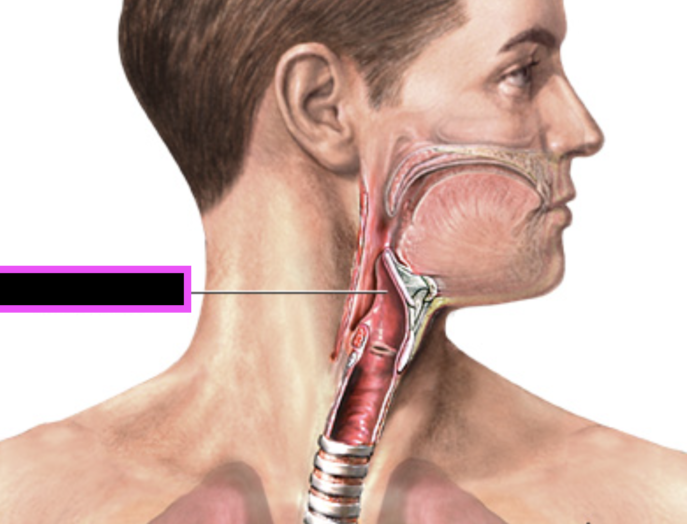 term image
