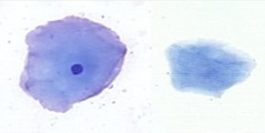 <p>Superficial cells</p>