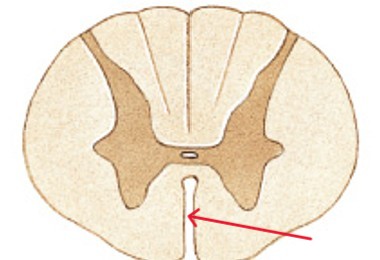 <p>What part of the spinal cord is:</p><ul><li><p>Deeper groove on anterior side</p></li></ul><p></p>