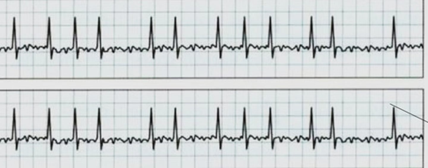 <p>What rhythm is this</p>