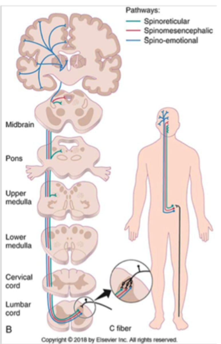 <p>- 1st order comes from body, comes in via afferent fiber to dorsal horn</p><p>- synapses with 2nd order in dorsal horn</p><p>- 2nd order decussates at level of spinal cord and out through ventral horn</p><p>- 2nd order terminates at brainstem/reticular formation</p>