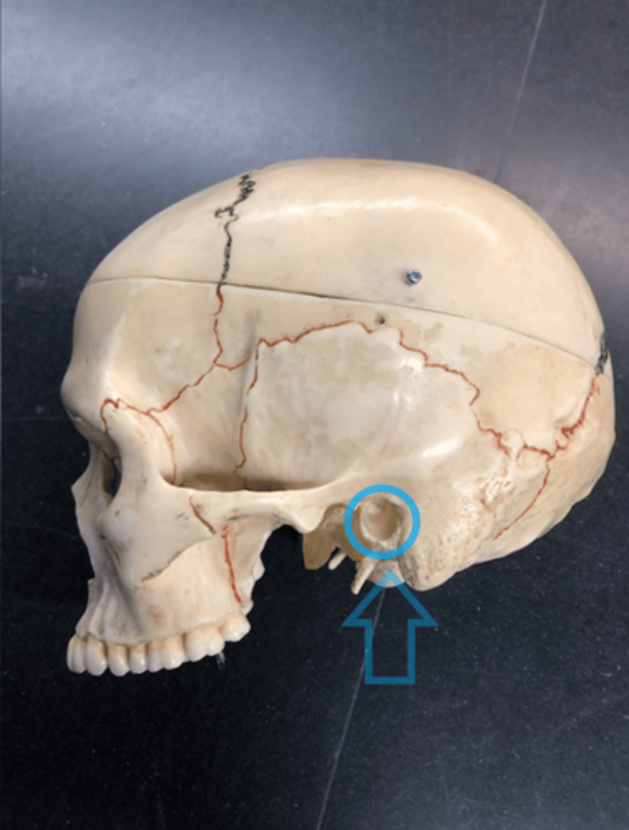 <p>Right behind mandibular fossa</p>