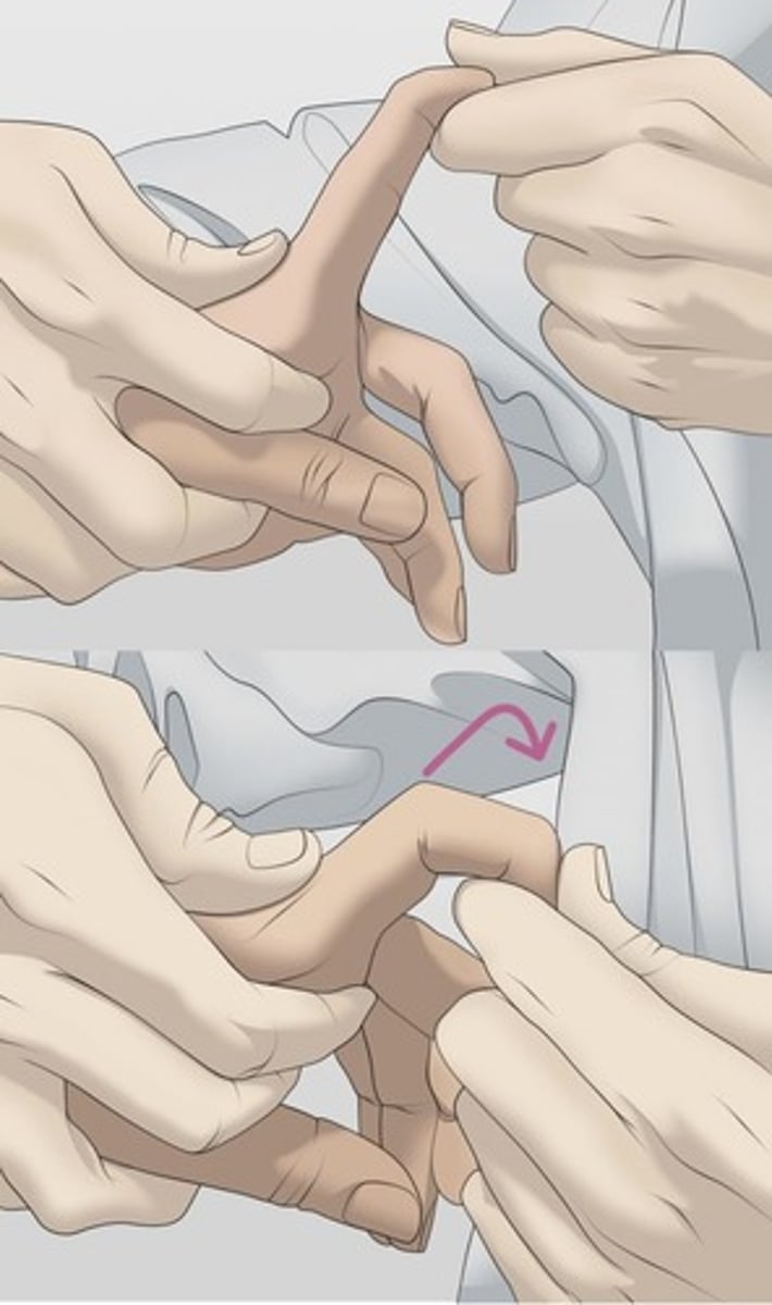 <p>Purpose: Intrinsic Muscle Tightness</p><p>Method: Pt is sitting with metacarpophalangeal joint in slight extension. PT moves the PIP joint into flexion</p><p>Positive Test: PIP joint does not flex with metocarpholageal joint in slight extension.</p>