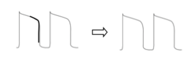 <p>normal K+ outward current ==&gt; normal action potential </p>