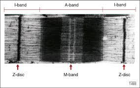 <ul><li><p>A band = DARK BAND that shows where the myosin is</p></li><li><p>I band = LIGHT BAND = only ACTIN</p></li><li><p>actin = THIN</p></li><li><p>myosin = THICK</p></li><li><p>H ZONE = area of just myosin</p></li><li><p>M line = centre of H zone</p></li><li><p>Z Disc = marks start and end of sarcomere</p></li></ul><p></p>