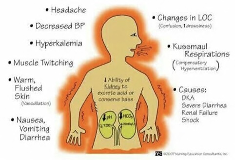 <ul><li><p>low pH, low HCO3</p></li><li><p>hyperventilation, hyperkalemia, muscle twitching, increased body temp.</p></li><li><p>check renal labs</p></li><li><p>causes: DKA, severe diarrhea, renal failure, shock</p></li></ul>