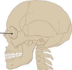Name this bone of the skull (lateral view).
